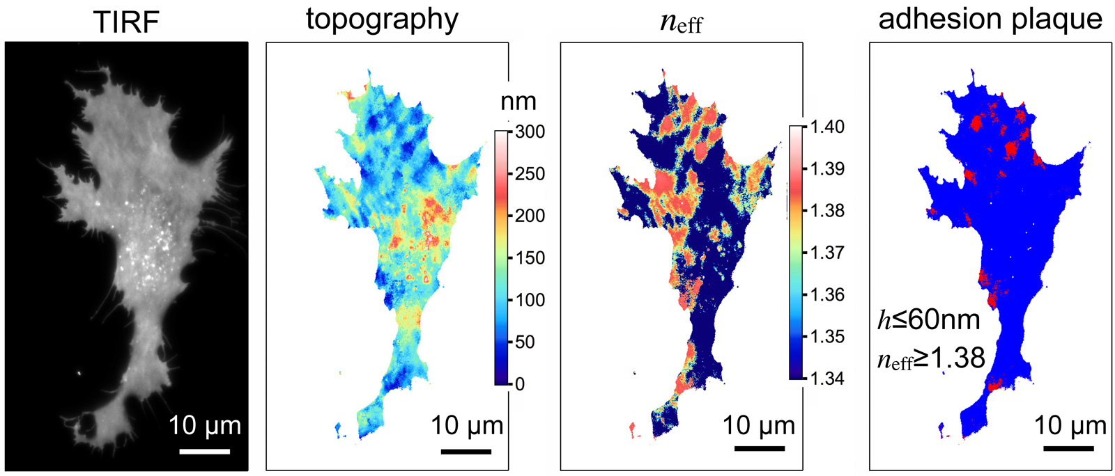 TIRF_fig3